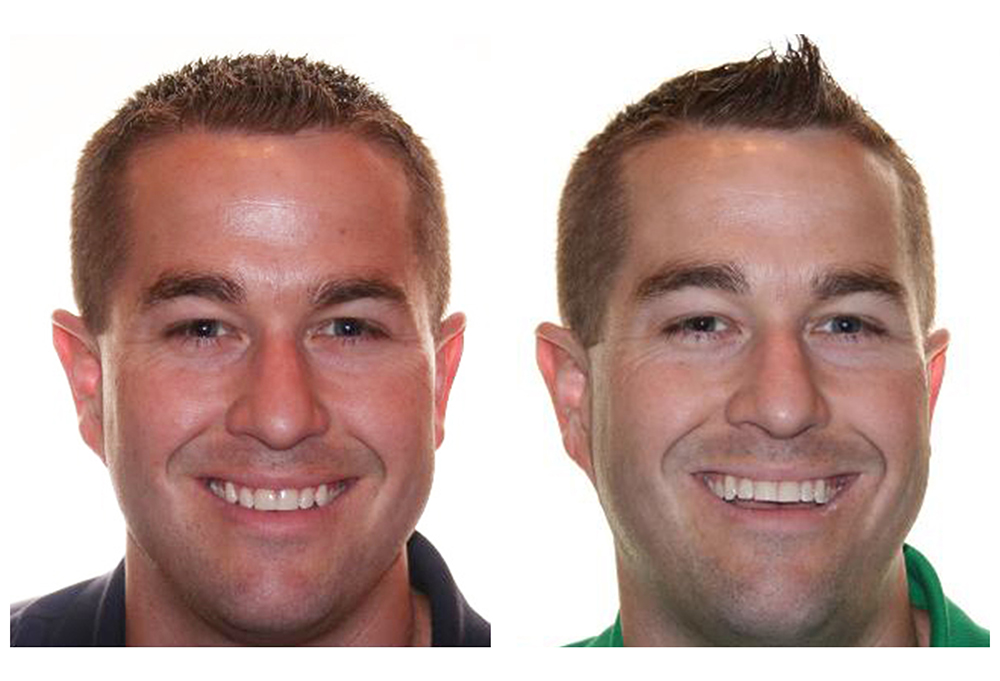 Silk Dental Delray Beach  formerly Marc Bilodeau DMD 