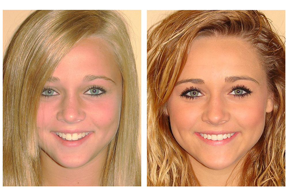 Silk Dental Delray Beach  formerly Marc Bilodeau DMD 